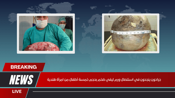 جراحون ينجحون في استئصال ورم ليفي ضخم بحجم خمسة أطفال من امرأة هندية